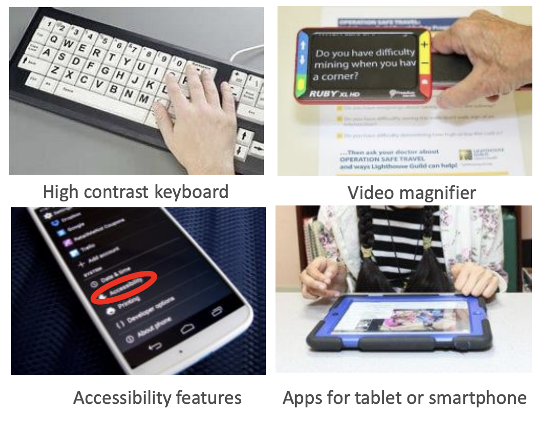 <ul><li><p>Adaptive computer equipment and software</p></li><li><p>Video magnification systems</p></li><li><p>Tablets and smartphones with accessibility feature</p></li><li><p>Apps designed for people with low vision</p></li></ul><p></p>