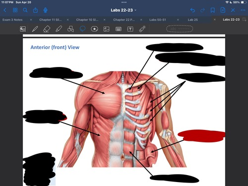 <p>What muscle is this?</p>