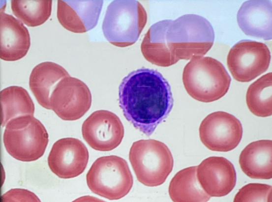<p>Identify this leukocyte and state what color it stains</p>