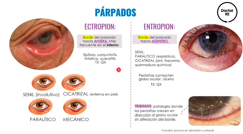<ol><li><p>SENIL </p></li><li><p>CICATRIZAL </p></li><li><p>PARALITICO </p></li><li><p>MECANICO</p></li></ol><p></p>