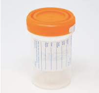 <p>‘Non Sterile’ Urine Container</p>