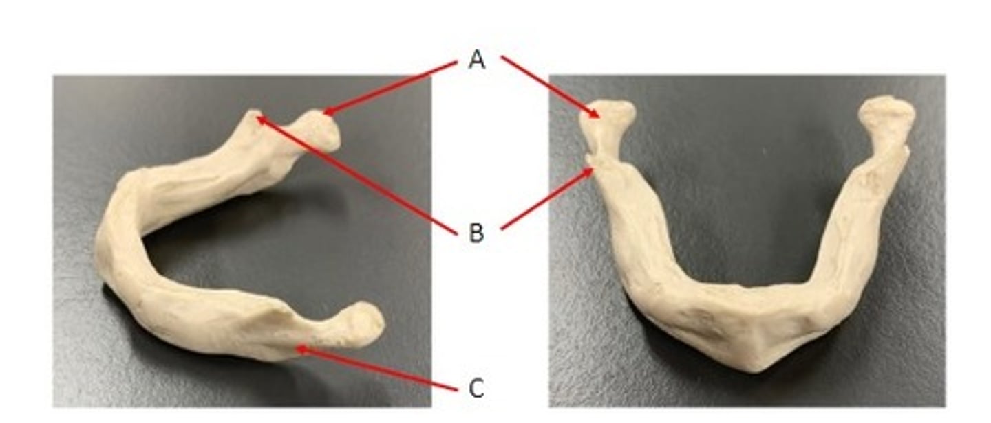 <p>Identify</p>