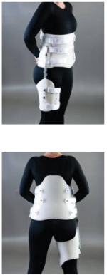 <p>Name this LSO. How is it constructed? Motion limitation?</p>