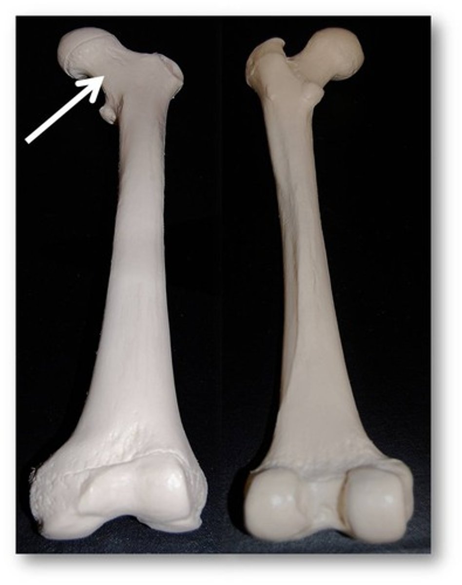 <p>Name this specific part of the femur.</p>