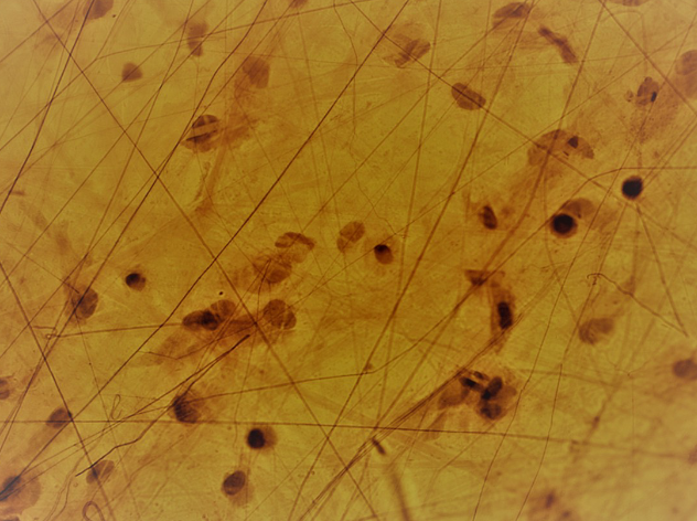 <p>A loose connective tissue that provides support and elasticity; fibroblasts, elastic and collagen fibers</p>