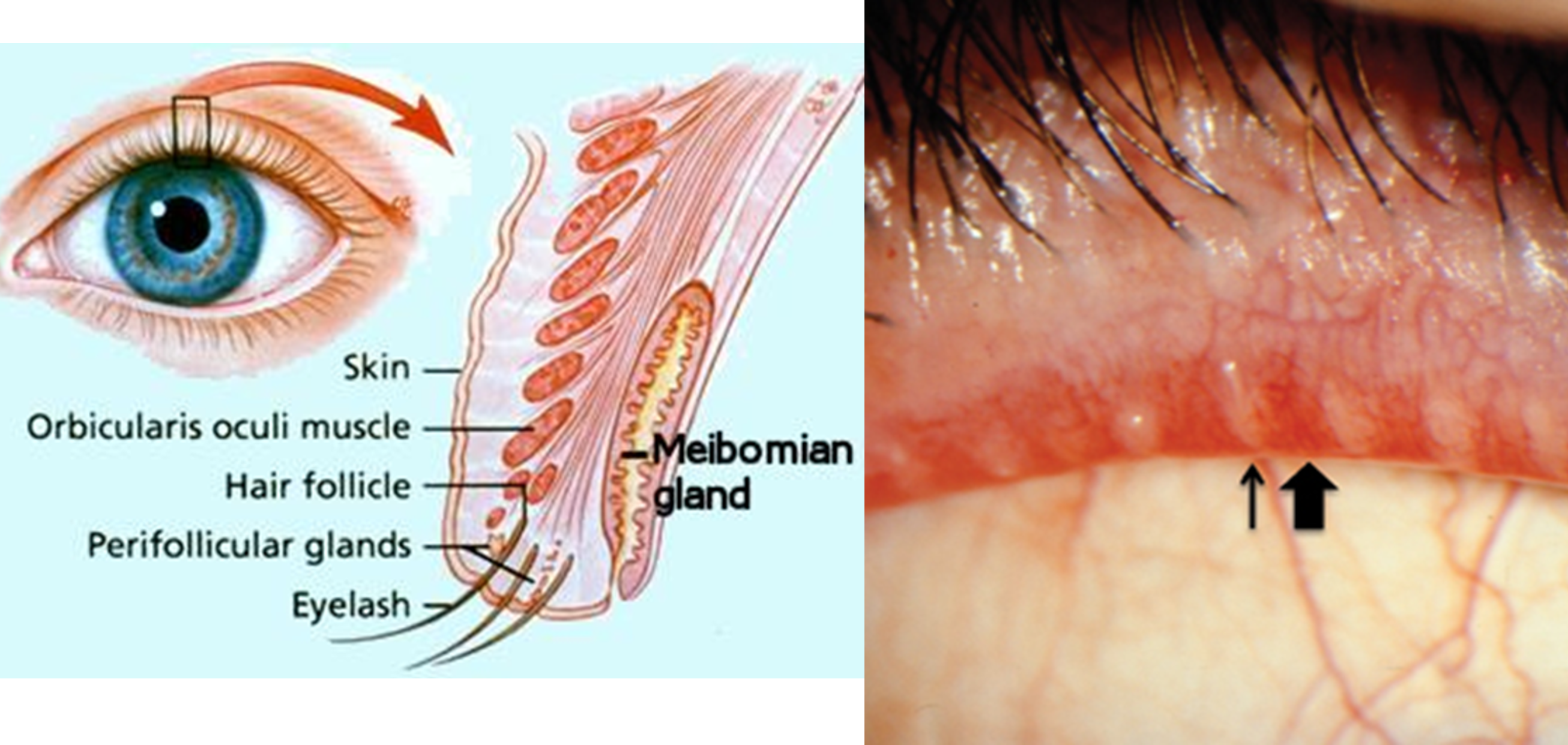 <p>modified sebaceous glands that secrete lipid rich product that keeps eyelid from sticking together </p>