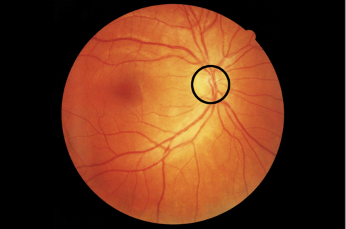 <p>blind spot</p>