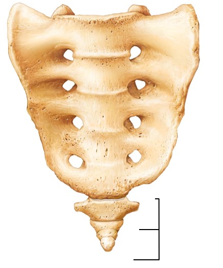 <p>What kind of vertebrae is the arrow pointing to?</p>