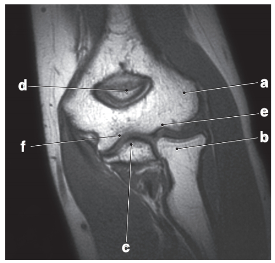 <p>What is letter b?</p>