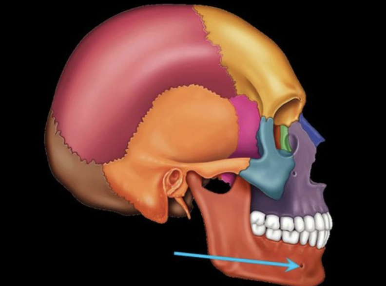 term image
