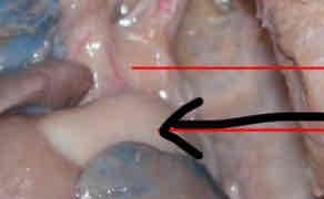 <p>Identify this structure</p>