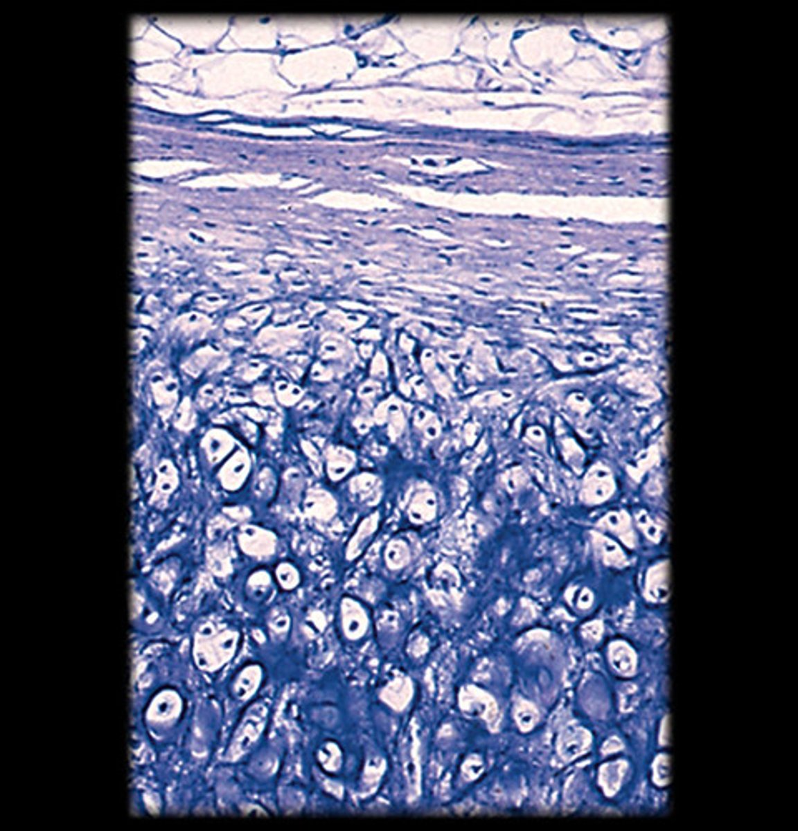 <p>- Dense network of elastic fibers.</p><p>- Chondrocytes in lacunae are visible, but the matrix is more flexible than hyaline cartilage.</p><p>- Appears as dark, thread-like elastic fibers surrounding the chondrocytes.</p><p>- Found in the ear and epiglottis.</p>