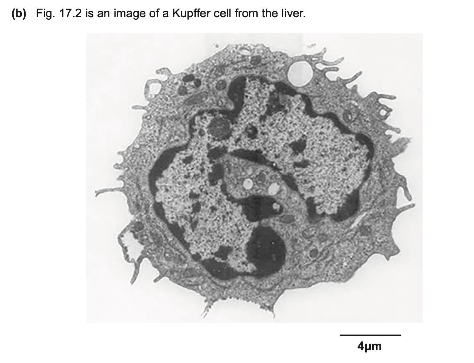 <p>type of microscope used</p>