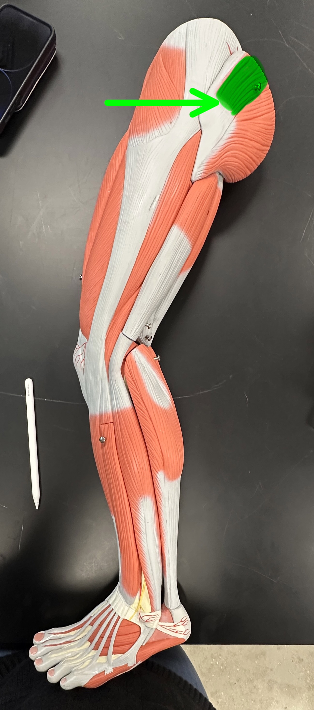 <p>What is the highlighted structure</p>