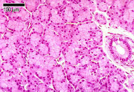 <p>Gland that releases secretions into ducts leading to epithelial surfaces.</p>