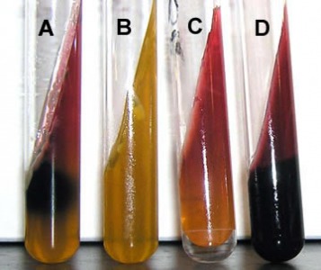 <p>What results are indicated by tube D?</p>
