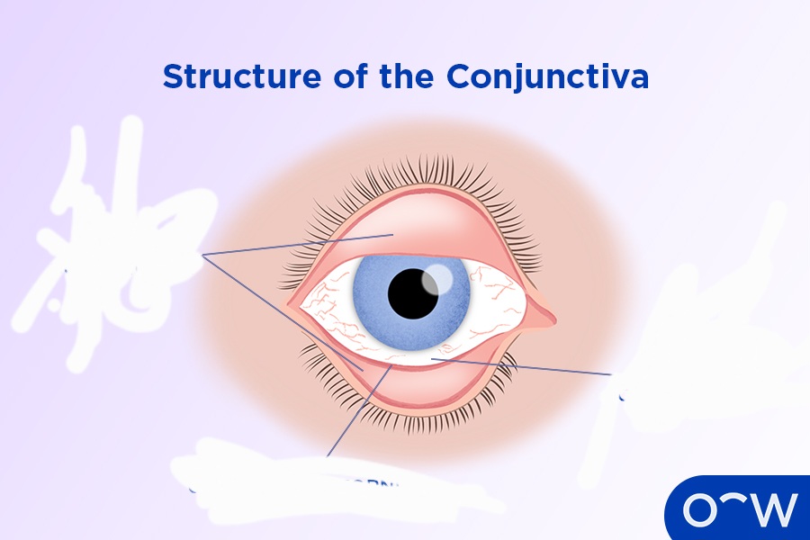 <p>The portion of the conjunctiva that covers the inner surface of both the upper and lower eyelids.</p>