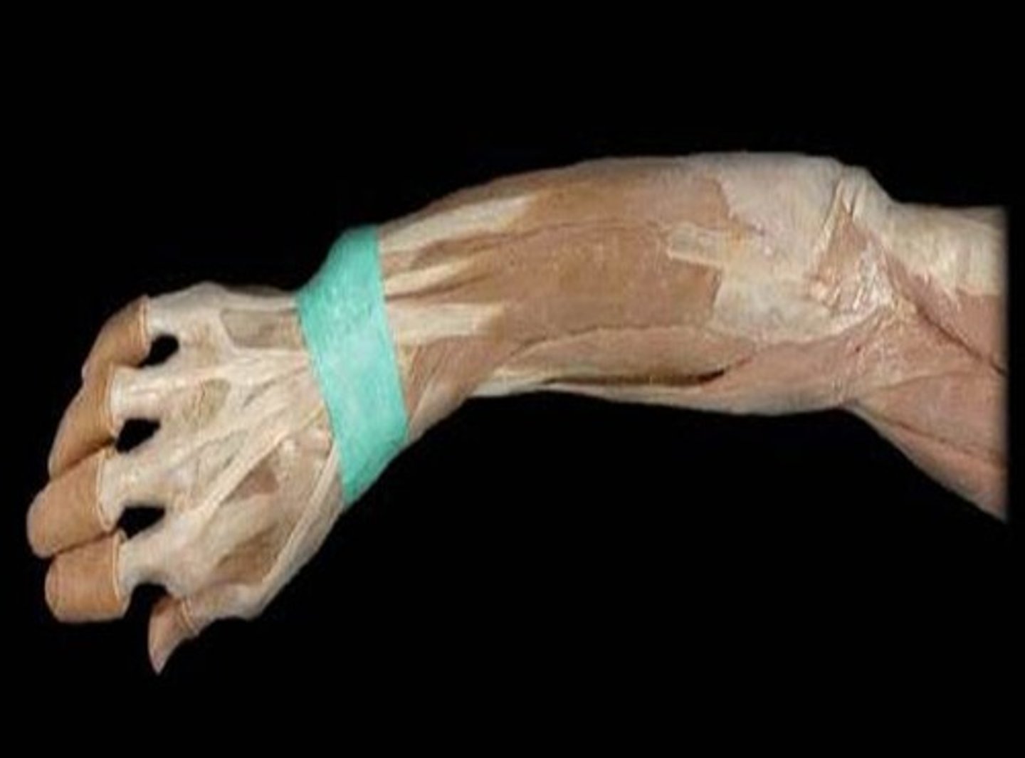 <p>in the posterior region, retains extensor tendons in place</p>