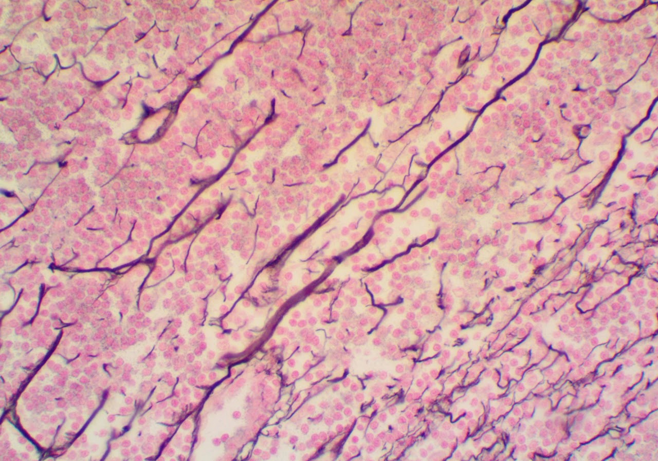 <p>Reticular loose fibrous connective tissue</p>