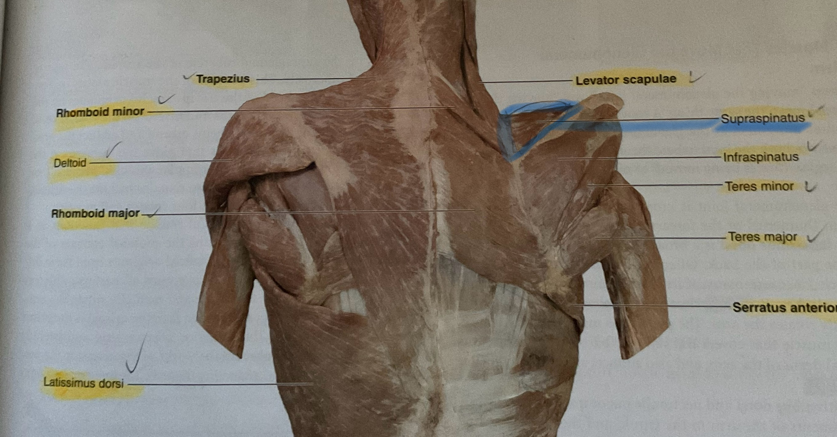 <p>Orgin: Clavicle</p><p>Insertion: Deltoid Tuberosity</p><p>Action: Abduct glenohumeral joint </p>