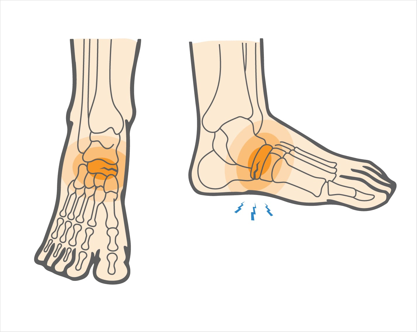 <p>sentisve with lots of nerves in the tarsals</p>