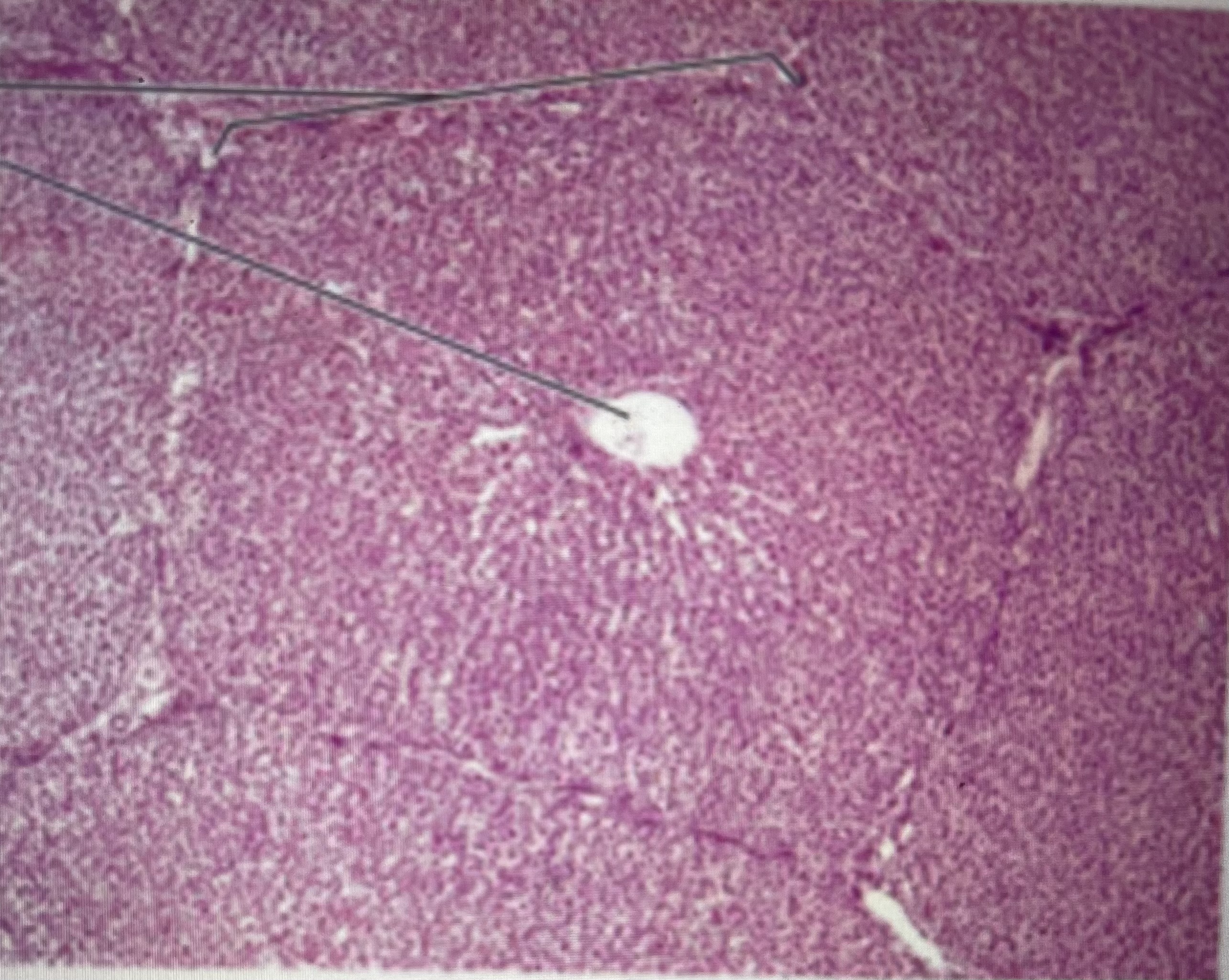 <p>(donut shaped) hepatocytes; arterioles; venules </p>