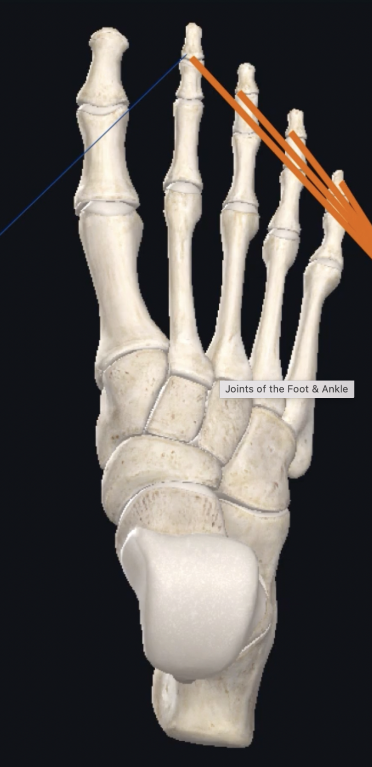 <p>What is this joint? </p>