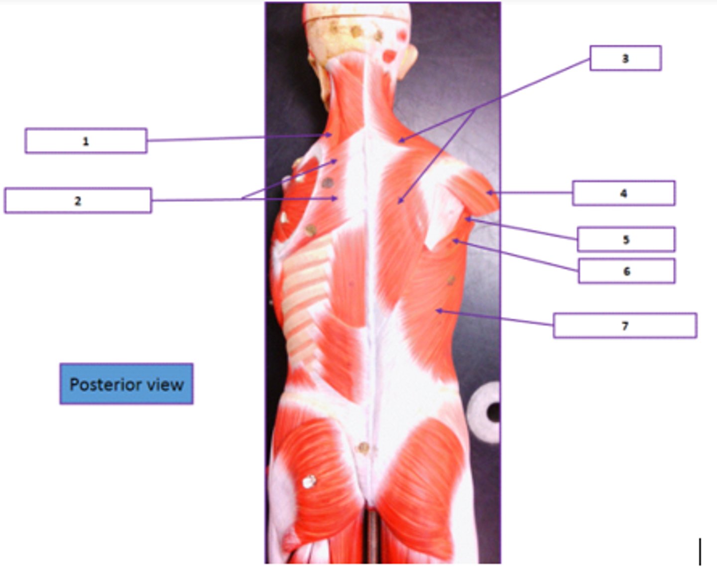 <p>Identify the muscle labeled 3.</p>