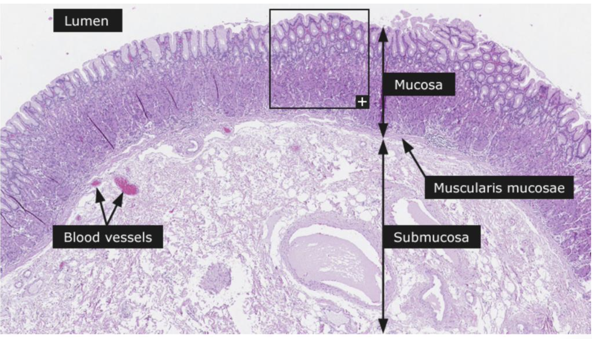  **-Gastric glands are mostly mucous cells** 