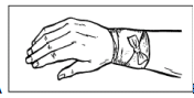 <p>type of wrapping to end other bandage patterns, such as a pressure bandage, or to cover small dressings</p>