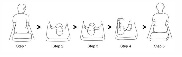 <p>Located in the posterior canal BPPV</p><ol><li><p>Head rotated 45deg to <strong>affected </strong>side and swifty brought down into 30deg extension off the edge of bed. Hold for 1 minute and observe.&nbsp;</p></li><li><p>Rotated 90deg to other side.&nbsp;Hold for 1 minute and observe. Symptoms should relieve.</p></li><li><p>Roll patient onto unaffected shoulder. Hold for 1 minute. Guide patient back up.&nbsp;</p></li></ol><p></p>