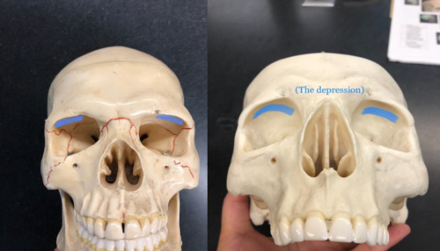 <p>Superolateral (above and toward the side) depression within eye socket</p>