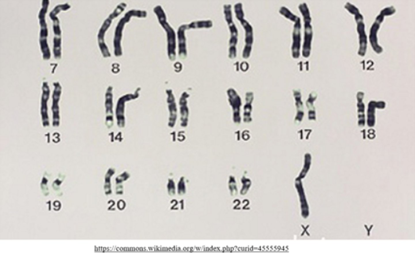 <p>monosomy</p><p>(ex: monosomy X = Turner syndrome)</p>