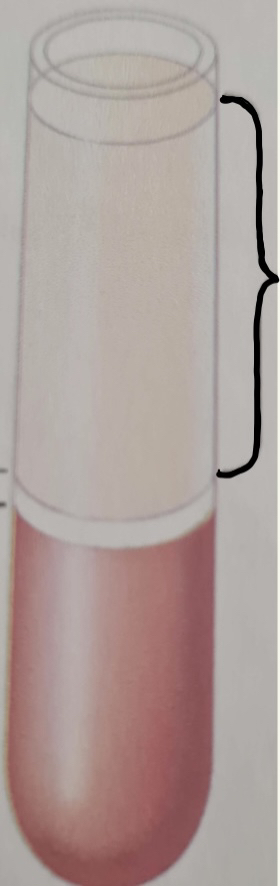 Plasma