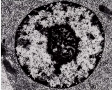 <p>Identify the following structures in electron micrograph (the whole structure)</p>