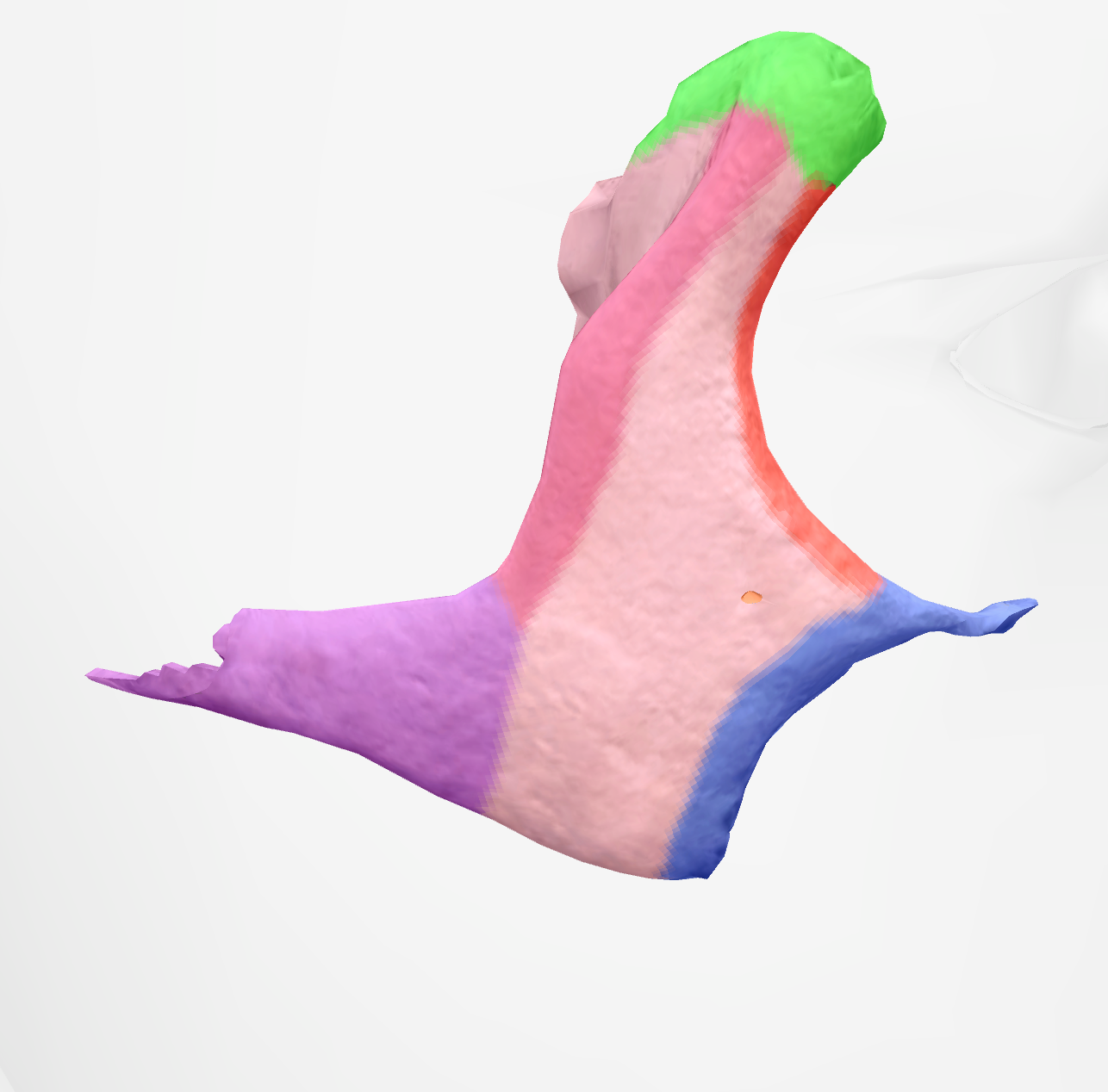 <p>cheek bone that looks like an anchor </p>