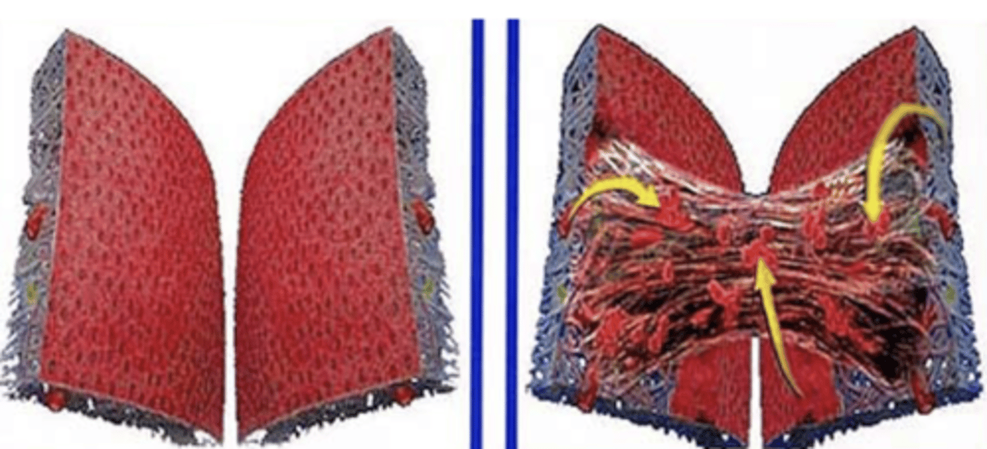 <p>Unwanted connections between neighboring tissues</p><p>- Larger fibrofatty infiltrates adhering adj. tissues together</p><p>Bonds that you DONT want to occur!</p>
