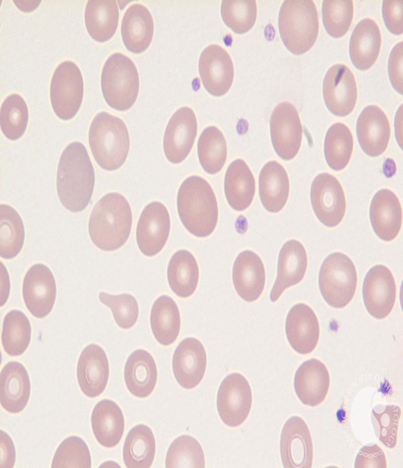 <p><span>Dacrocyte</span></p>