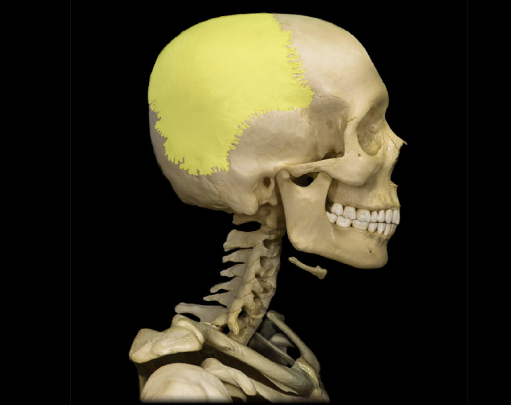 <p>Parietal bone</p>