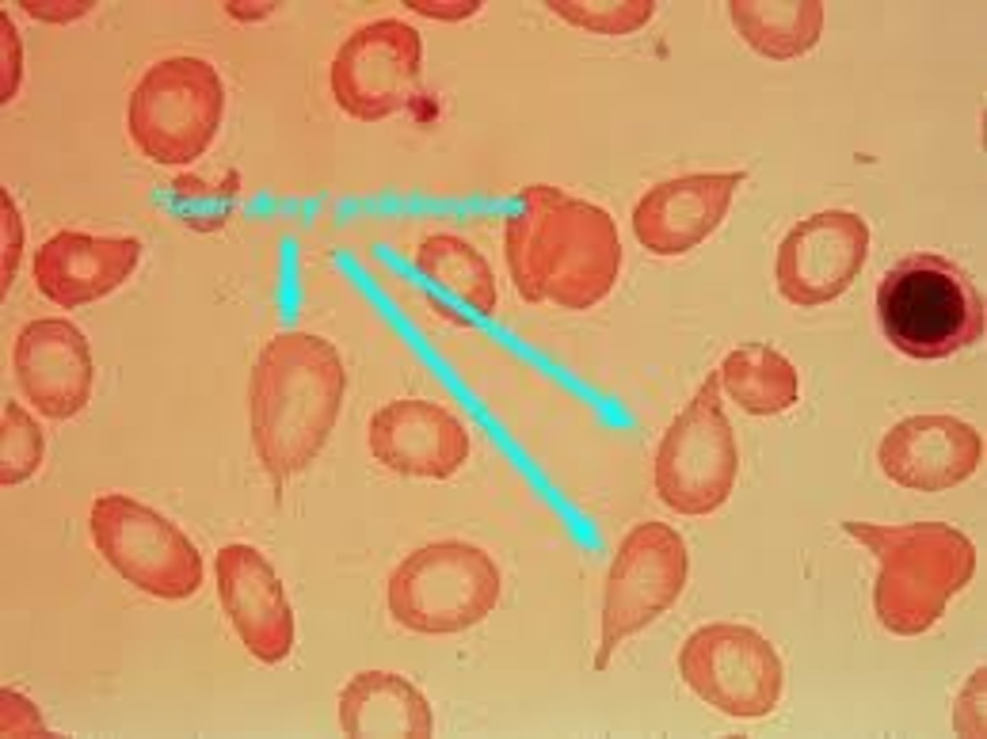 <p>Cells are irregularly shaped</p>