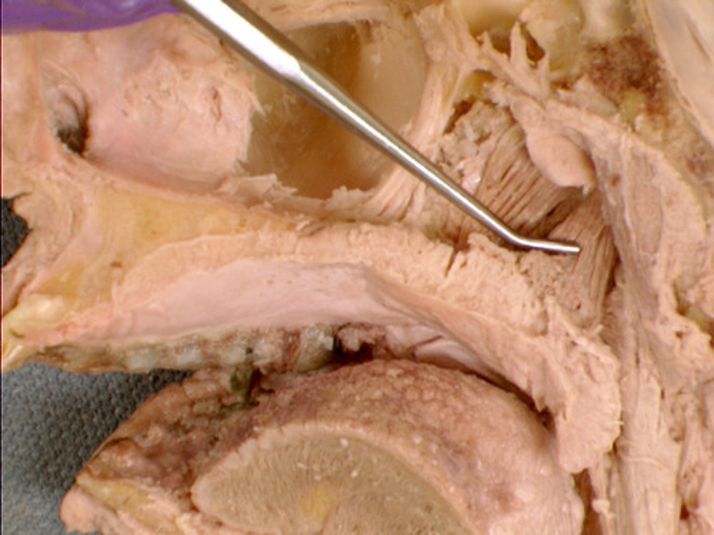 <p><em>identify the structure:</em></p>