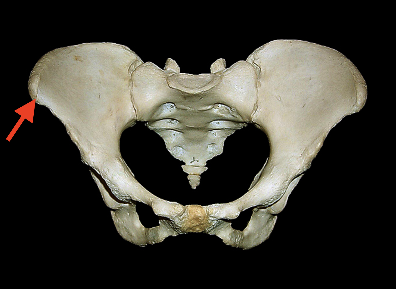 <p>What bone is this? What structure is the arrow pointing to? View?</p>