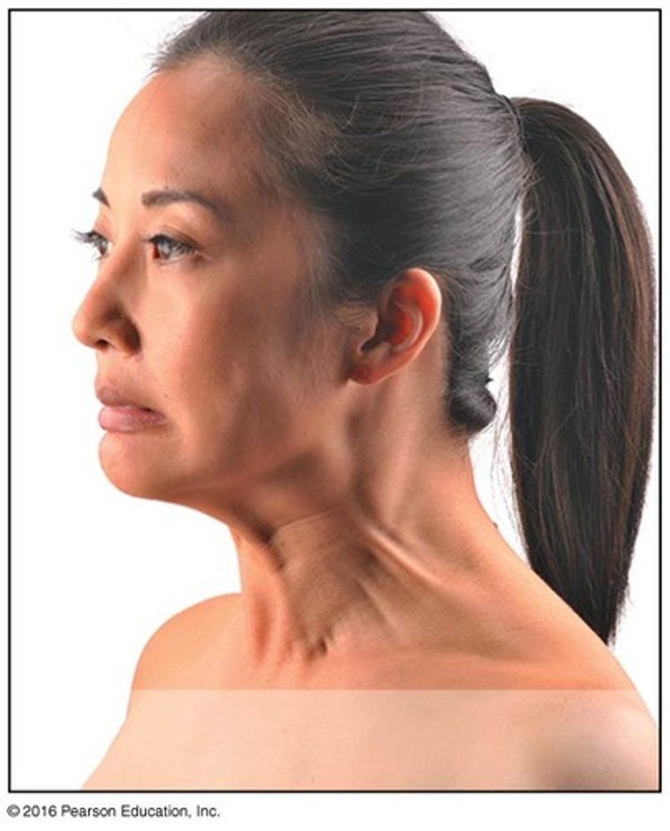 <p>Tenses skin of neck; pulls lower lip back and down</p>