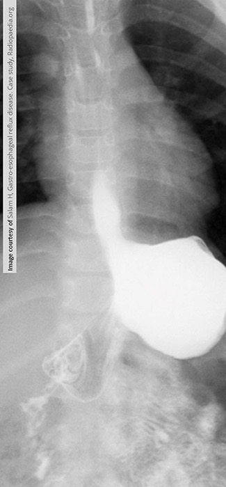 term image