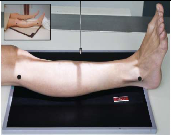 <p>Patient Position   </p><p class="p2"><span style="line-height: normal;"><span>• </span></span>Lying on x-ray table</p><p class="p2"><span style="line-height: normal;"><span>• </span></span>Affected leg extended</p><p class="p2"></p><p class="p2">Part Position</p><p class="p2"><span style="line-height: normal;"><span>• </span></span>Entire affected limb is in a true AP</p><p class="p2"><span style="line-height: normal;"><span>• </span></span>Affected foot is dorsiflexed 90<span style="line-height: normal;"><span>o</span></span></p><p class="p2"></p><p class="p2">CR</p><p class="p2"><span style="line-height: normal;"><span>• </span></span>perpendicular to the IR; centered to midshaft region of tib/fib</p><p class="p2"></p><p class="p2">Collimation</p><p class="p2"><span style="line-height: normal;"><span>• </span></span>Knee to ankle must be included</p><ul><li><p class="p2"><span style="line-height: normal;"><span> </span></span>Usually requires the IR to be placed diagonally</p></li><li><p class="p2"><span style="line-height: normal;"><span> </span></span>May also require increase SID</p></li></ul><p></p>