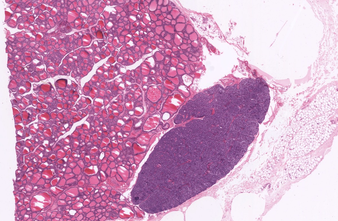 <p>Parathyroid gland</p>