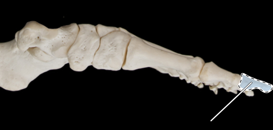 <p>Bones of the foot, medial view</p>