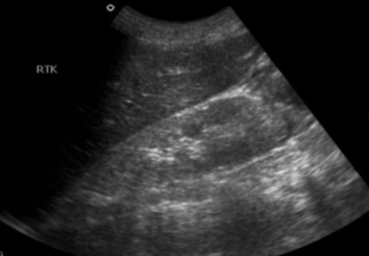 <p>What is seen here?</p>