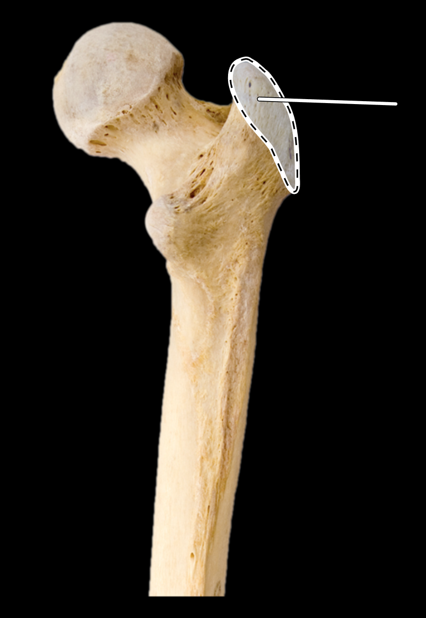 <p>Name the highlighted portion.</p><p>(Femur, posterior view, right side).</p>