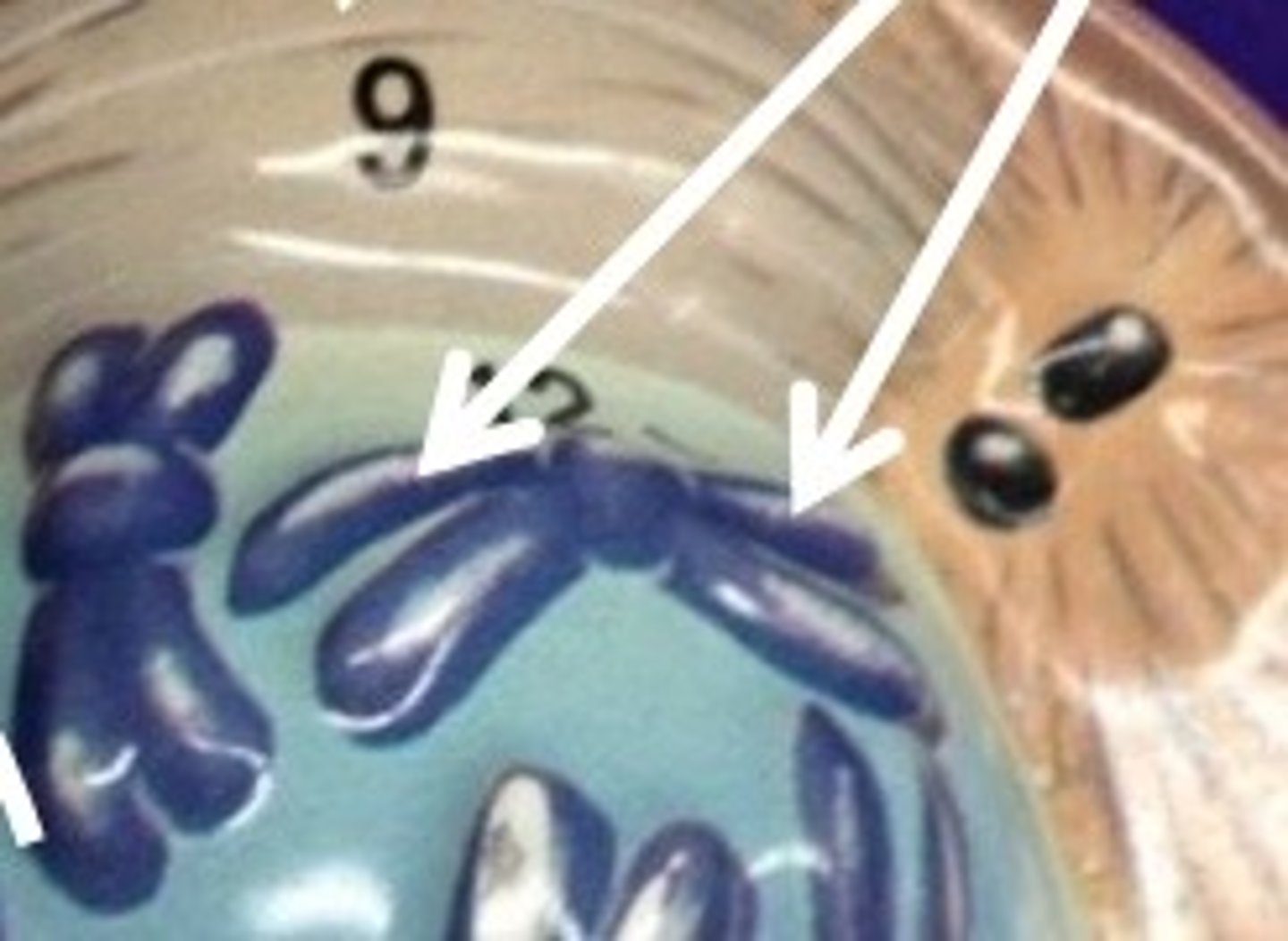 <p>#12</p>